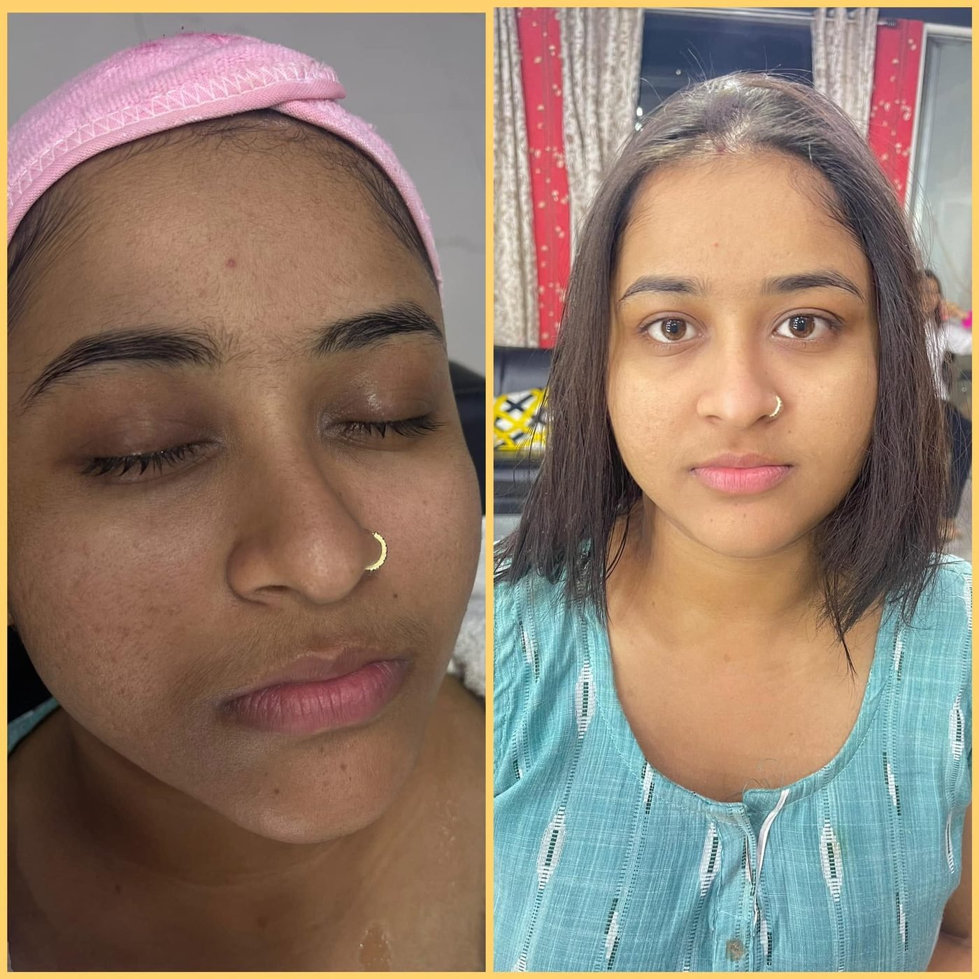 Skin Glow Therapy